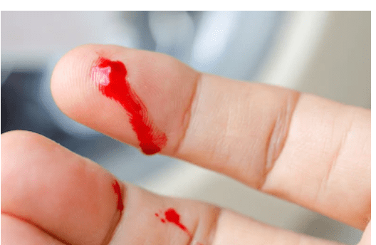 Un bărbat și-a amputat degetul când tăia lemne